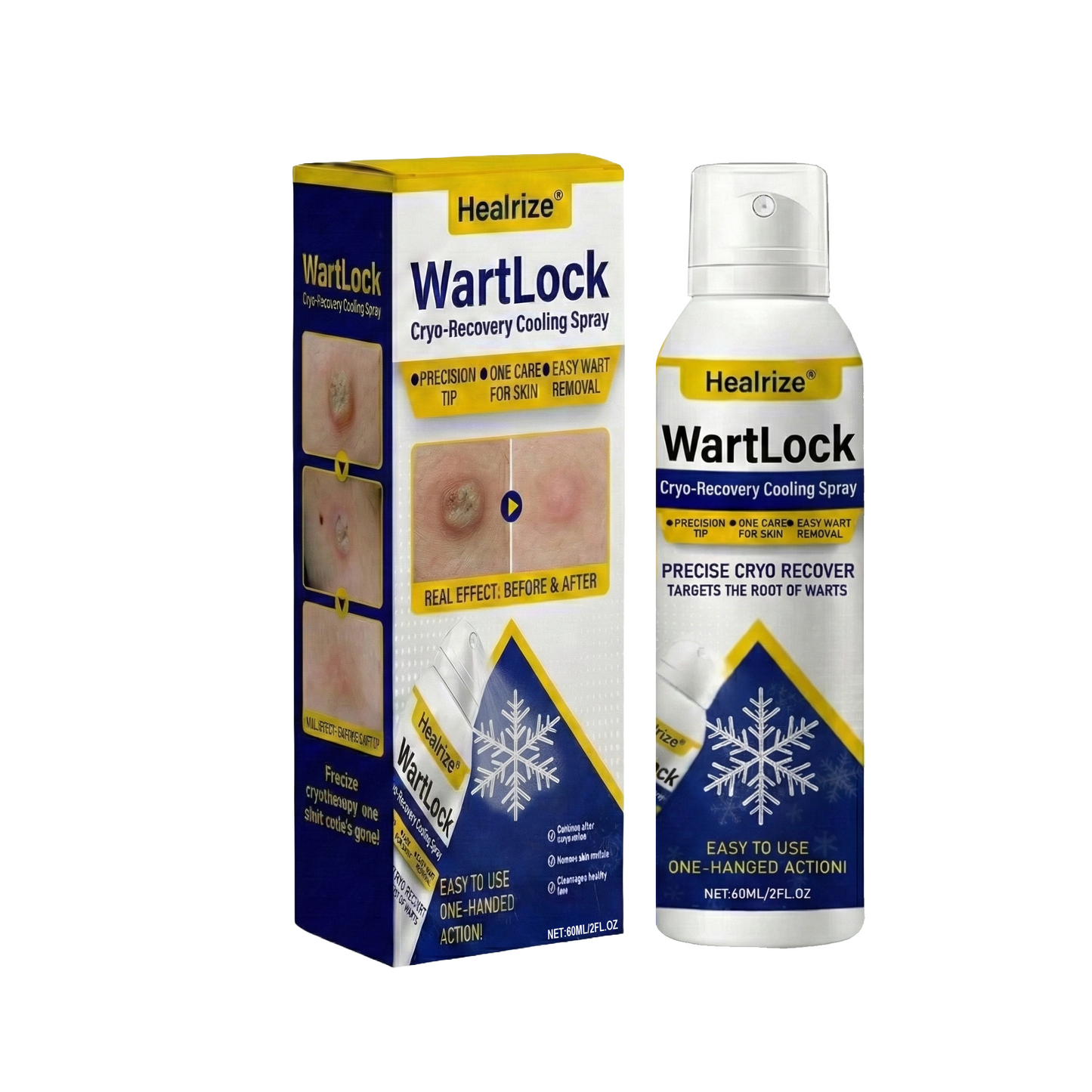 🔥Best Seller🔥Healrize® WartLock Cryo-Recovery Cooling Spray🎉Special limited-time discount