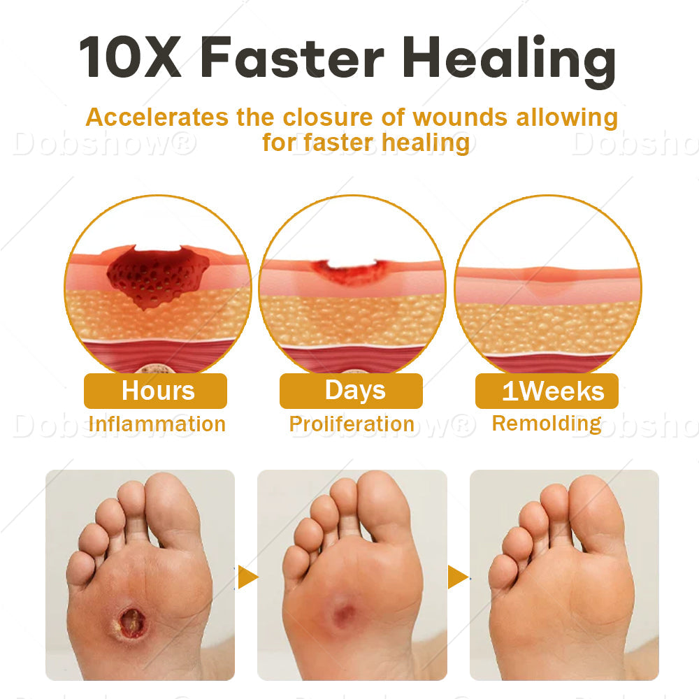 Best Seller🔥 Healrize® GlucoShield Bee Venom Wound Spray-Supports diabetic foot care & speeds up wound recovery 🎉Special limited-time discount