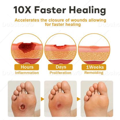 Best Seller🔥 Healrize® GlucoShield Bee Venom Wound Spray-Supports diabetic foot care & speeds up wound recovery 🎉Special limited-time discount