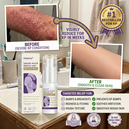 Healrize®  Stratum Corneum Soothing Spray
