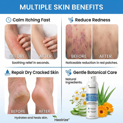 🎉Special limited-time discount | Healrize® Magnesium Botanical Spray – Advanced Skin Recovery for Psoriasis & Eczema | Rapid Soothing, Steroid-Free🚀Global Shipping