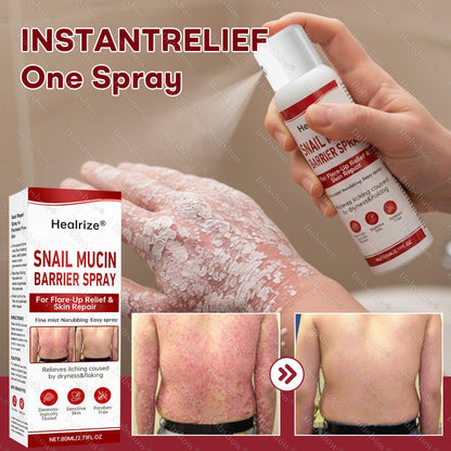 🔥Best Seller🔥Healrize® Snail Mucin Barrier Spray for Flare-Up Relief & Skin Repair🎉Special limited-time discount