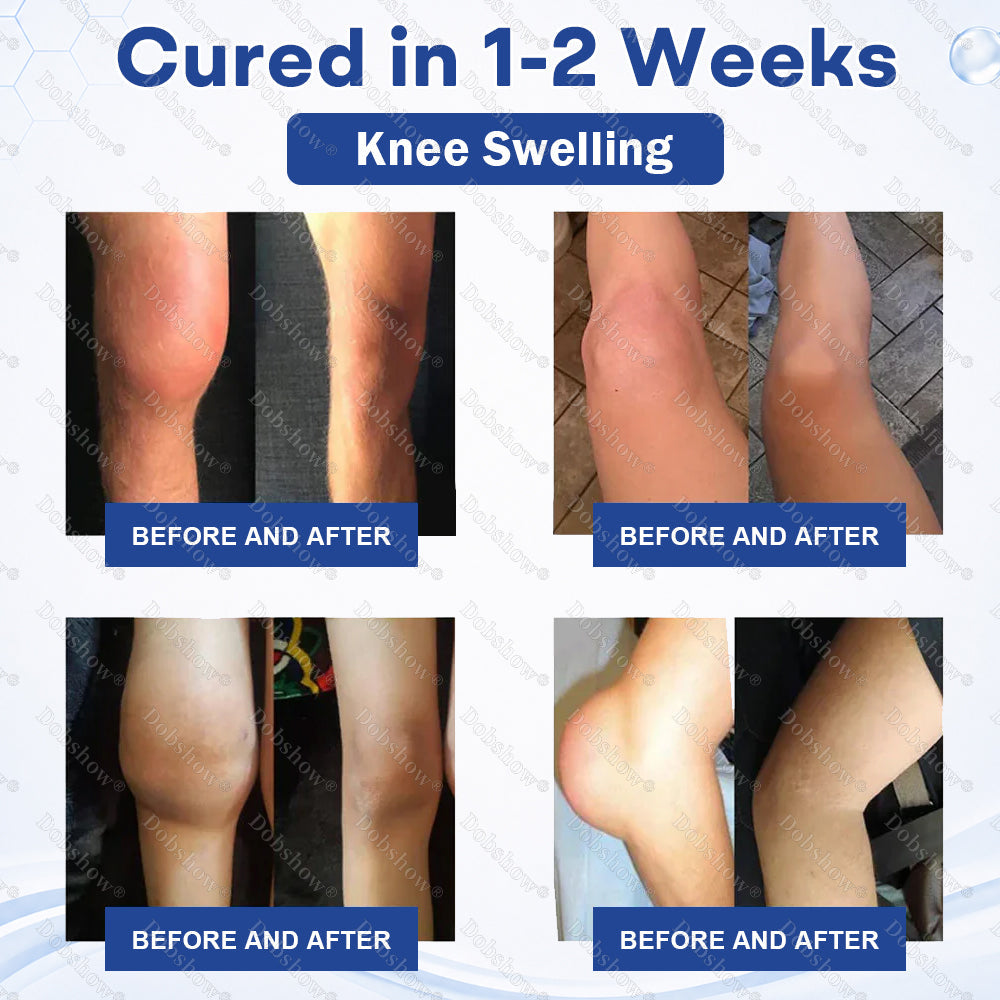 Healrize® Knee Joint Pain Relief Patches