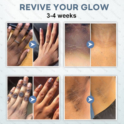 `Healrize® Niacin-Retinol Dual-Action Brightening Cream ✨