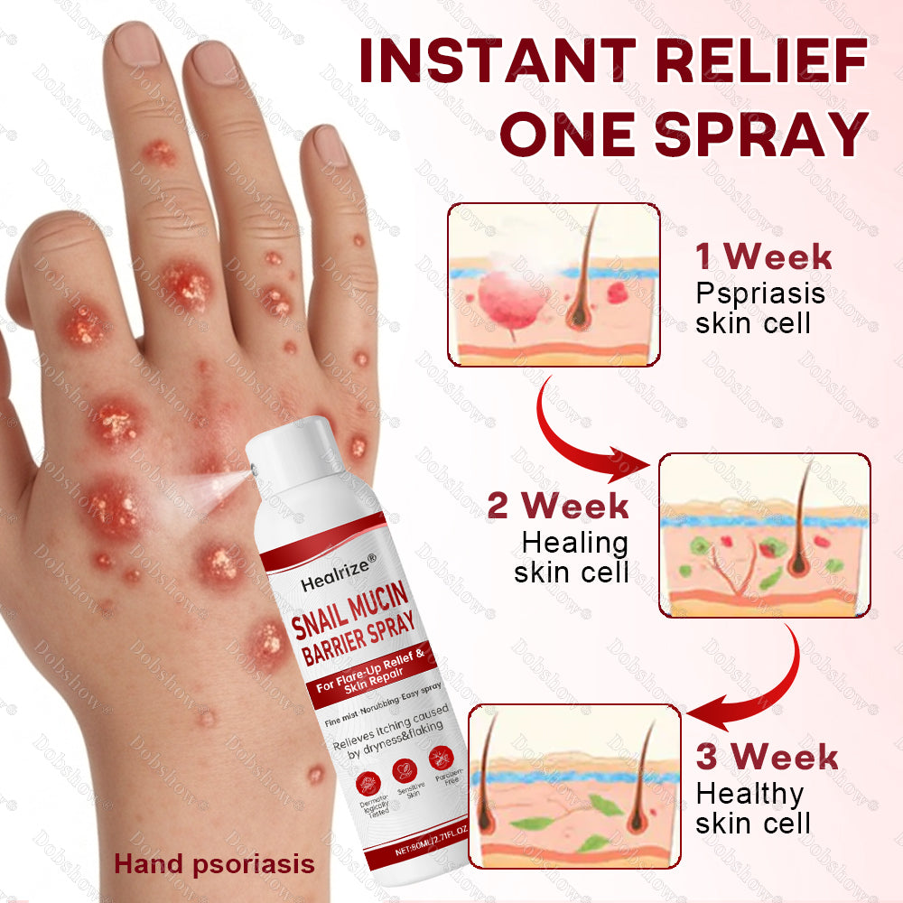 🔥Best Seller🔥Healrize® Snail Mucin Barrier Spray for Flare-Up Relief & Skin Repair🎉Special limited-time discount