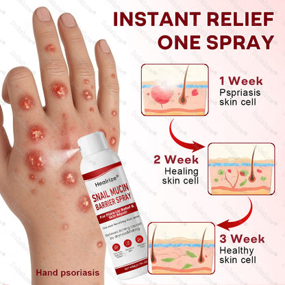🔥Best Seller🔥Healrize® Snail Mucin Barrier Spray for Flare-Up Relief & Skin Repair🎉Special limited-time discount