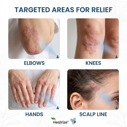 `Healrize® Magnesium Botanical Spray – Advanced Skin Recovery for Psoriasis & Eczema | Rapid Soothing, Steroid-Free