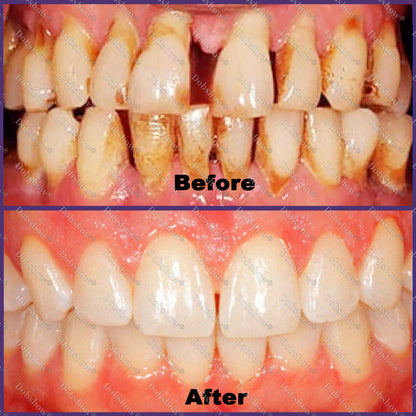 `🐝 Dobshow® ApiCore BeeVenom Vital Repair Toothpaste