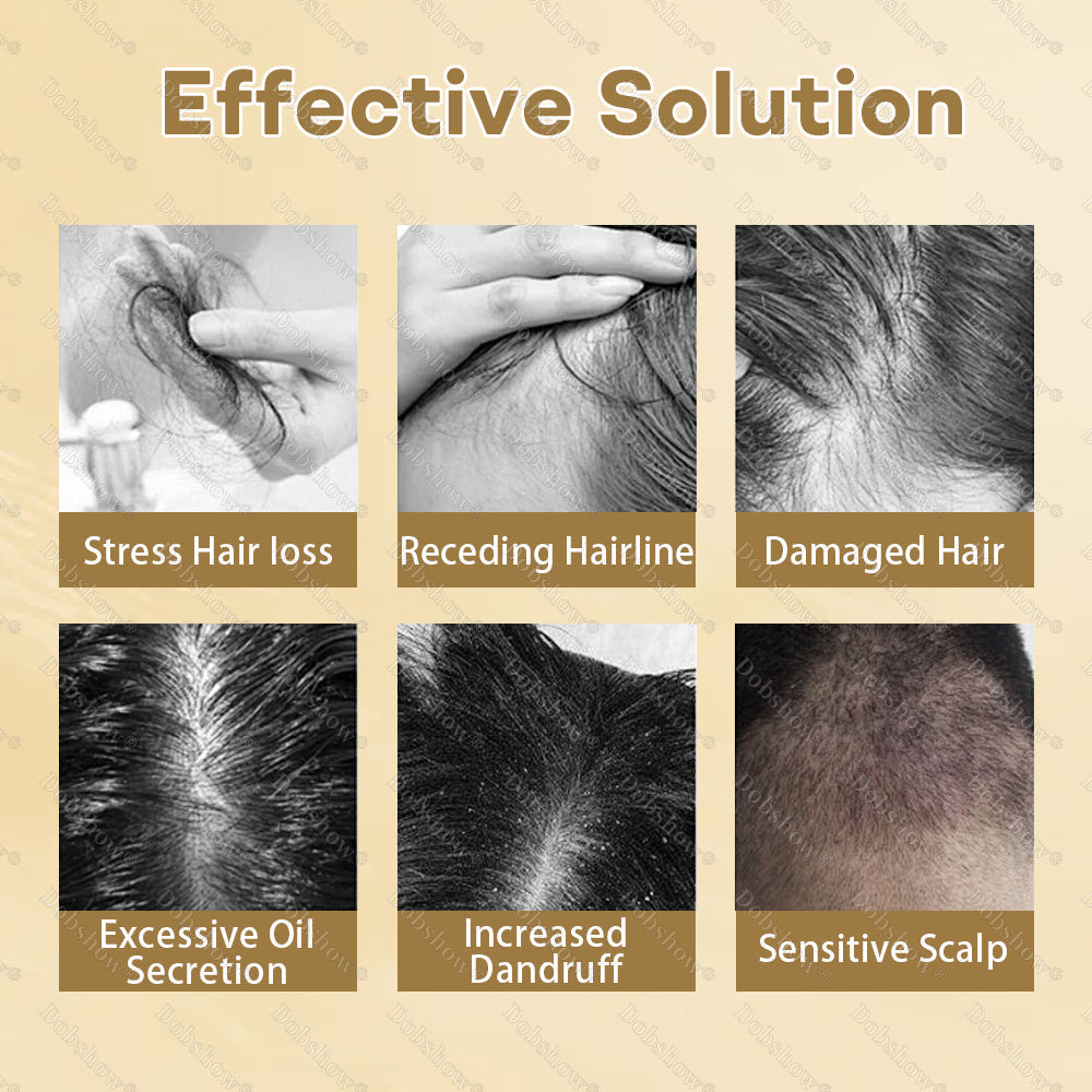Best Seller🔥 Healrize® Hair Regrowth Capsules, Newly Upgraded,Nano Penetration, Deep into Hair Roots🎉𝙇𝙞𝙢𝙞𝙩𝙚𝙙-𝙏𝙞𝙢𝙚 𝙊𝙛𝙛𝙚𝙧
