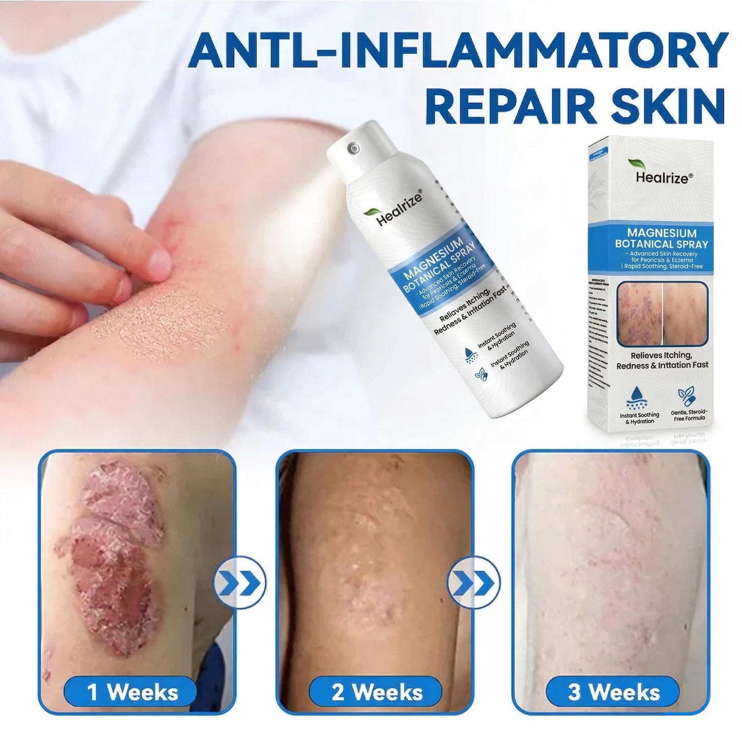 🎉Special limited-time discount | Healrize® Magnesium Botanical Spray – Advanced Skin Recovery for Psoriasis & Eczema | Rapid Soothing, Steroid-Free🚀Global Shipping