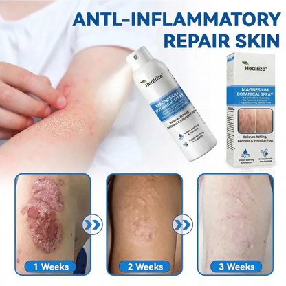 🎉Special limited-time discount | Healrize® Magnesium Botanical Spray – Advanced Skin Recovery for Psoriasis & Eczema | Rapid Soothing, Steroid-Free🚀Global Shipping