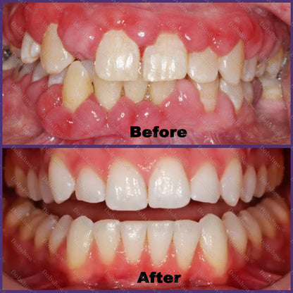 `🐝 Dobshow® ApiCore BeeVenom Vital Repair Toothpaste