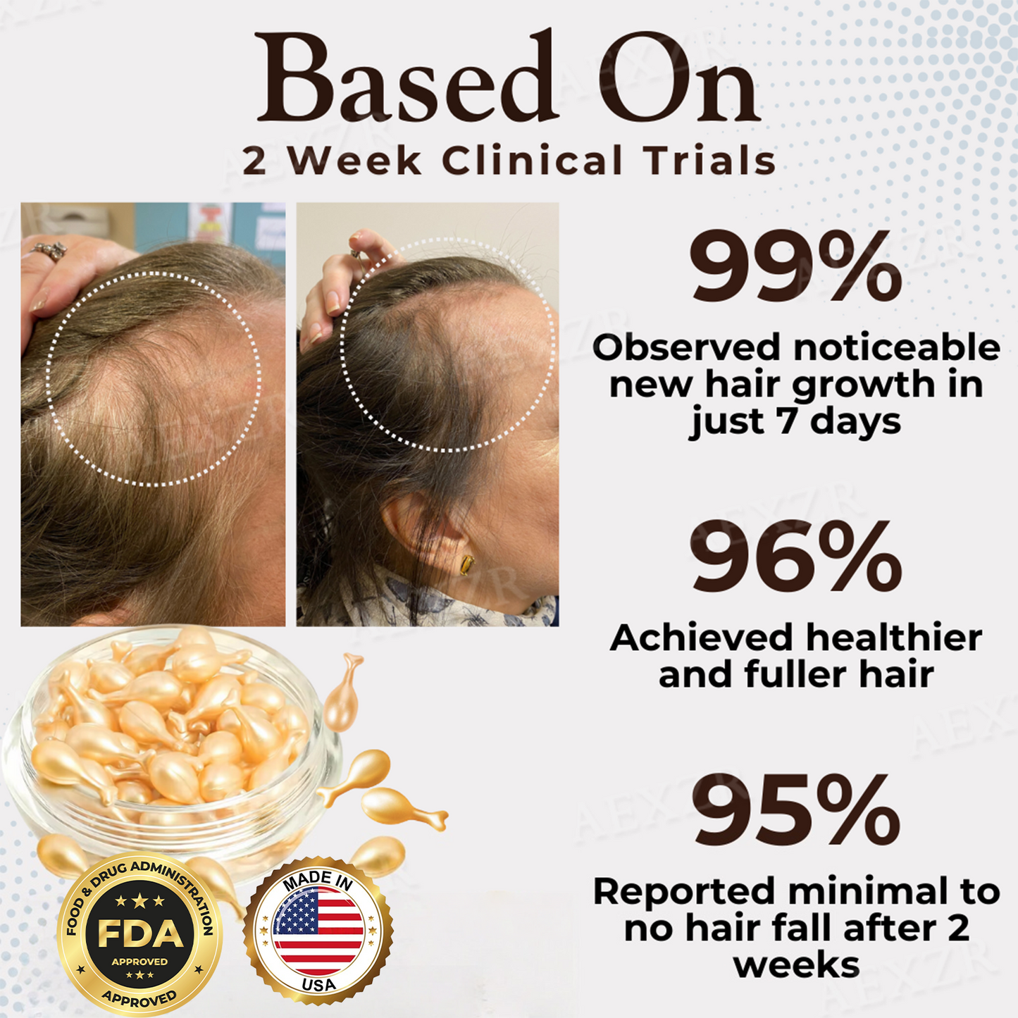 🔥𝙇𝙞𝙢𝙞𝙩𝙚𝙙-𝙏𝙞𝙢𝙚 𝙊𝙛𝙛𝙚𝙧 | Healrize® Hair Regrowth Capsules| Revive Follicles, Boost Hair Volume