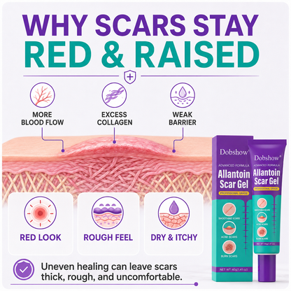 Dobshow® Allantoin Scar Gel- limited-time discount