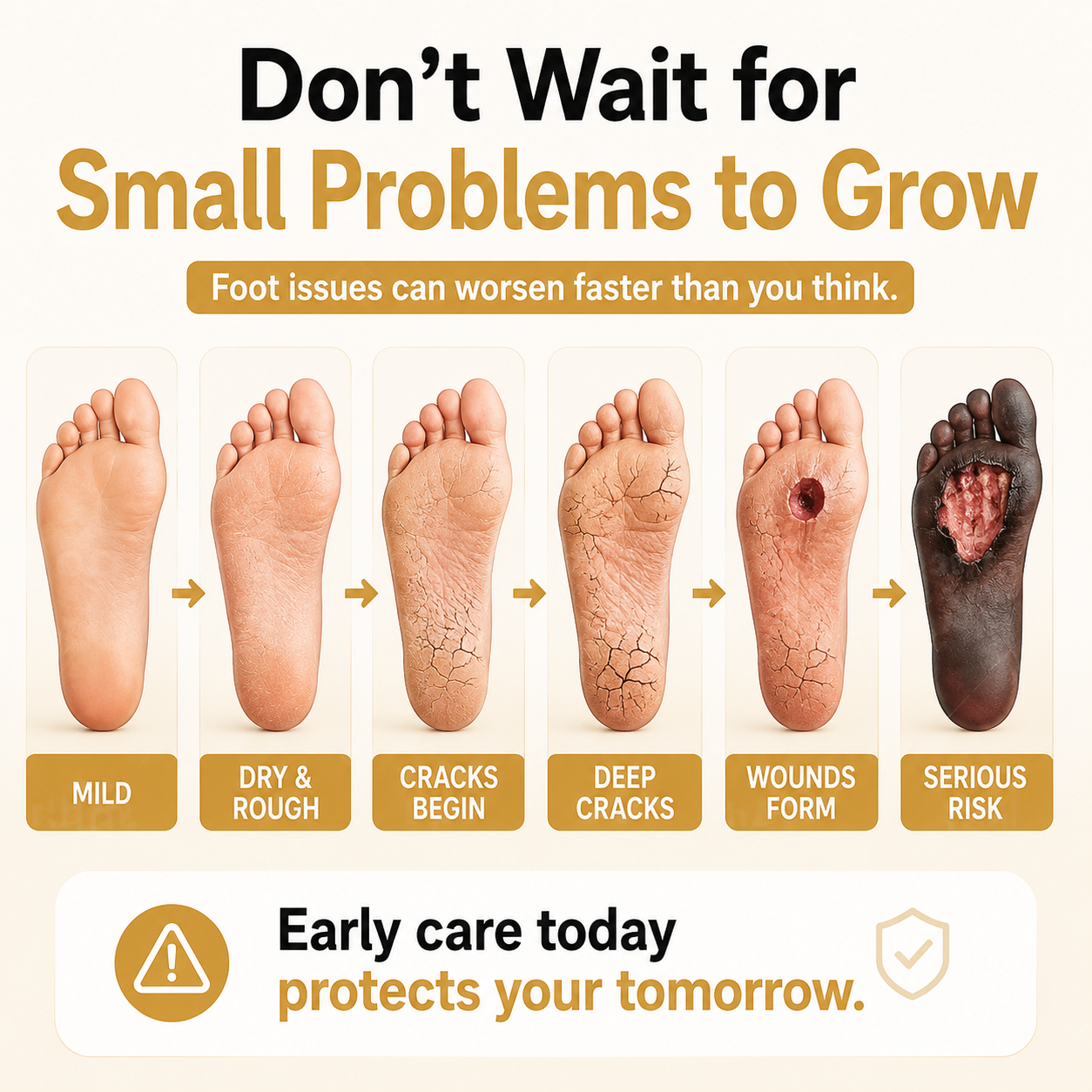 🎉Limited-time discount🎉Healrize®Bee Venom Intensive Diabetic Foot Treatment Spray🔥89K+SOLD🔥
