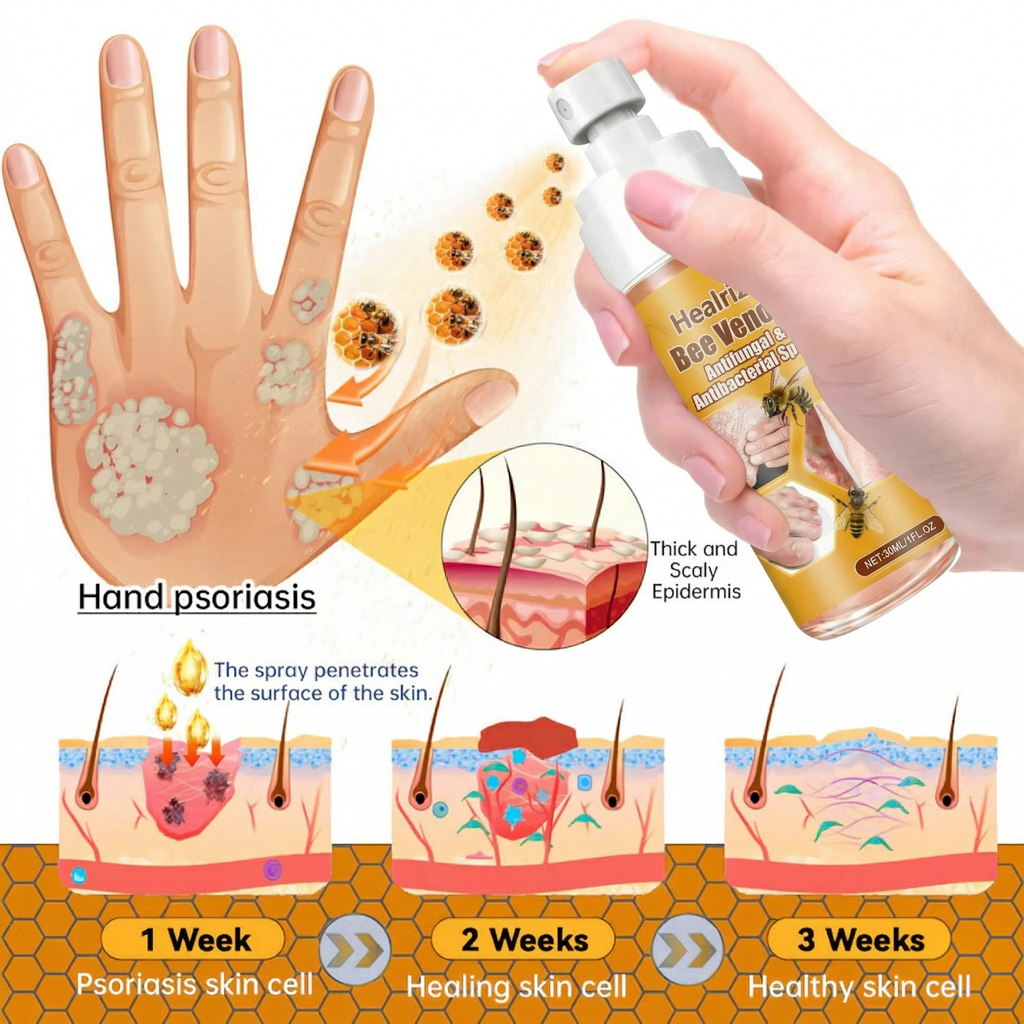 🔥Best Seller🔥Healrize® Bee Venom Antifungal & Antibacterial Spray🎉Special limited-time discount