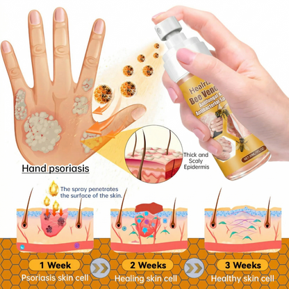 🔥Best Seller🔥Healrize® Bee Venom Antifungal & Antibacterial Spray🎉Special limited-time discount