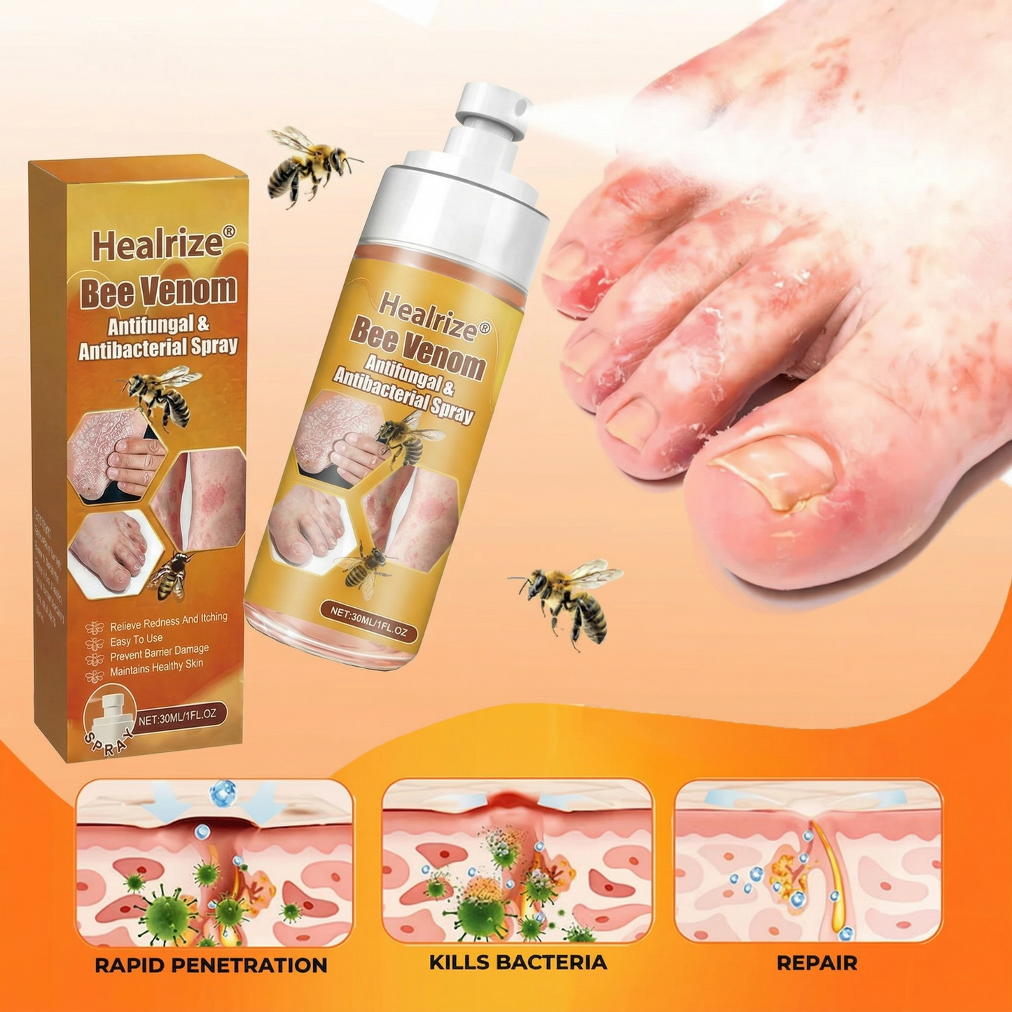 🔥Best Seller🔥Healrize® Bee Venom Antifungal & Antibacterial Spray– Advanced Skin Recovery for Psoriasis & Eczema🎉Special Limited Time 50% OFF